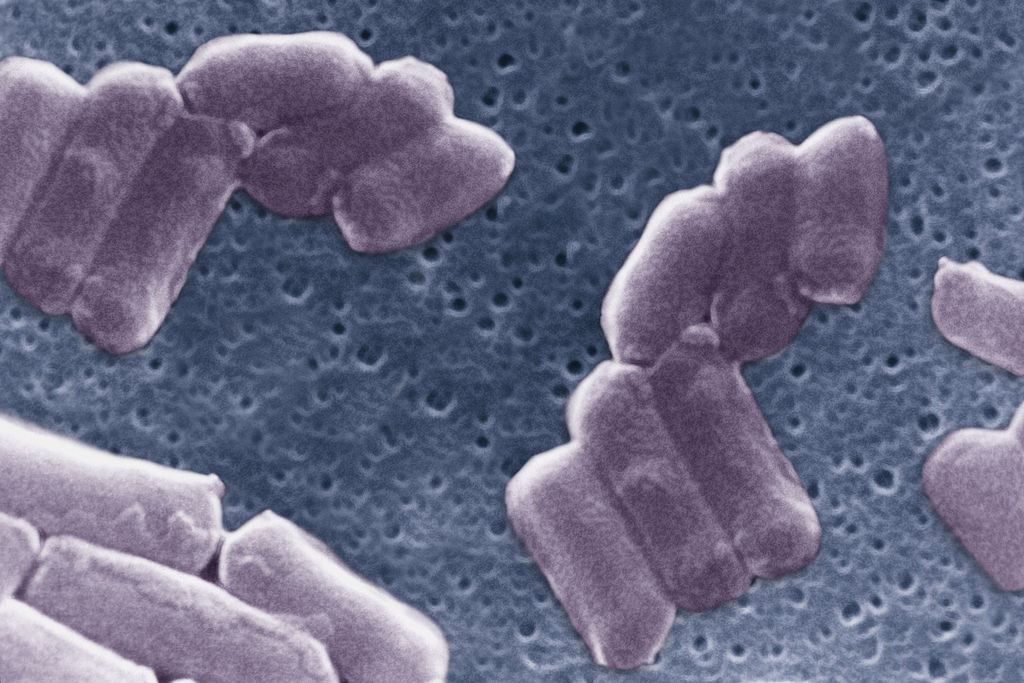 Bactéria Clostridium perfringens, encontrada no trato intestinal de humanos e outros vertebrados -