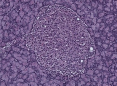 Ilhota pancreática, onde são encontradas células produtoras de insulina e que podem ser afetadas pela obesidade
