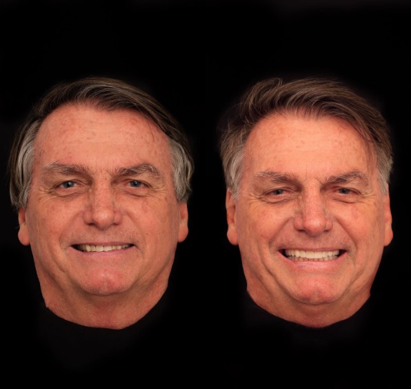 O novo sorriso de Jair Bolsonaro -