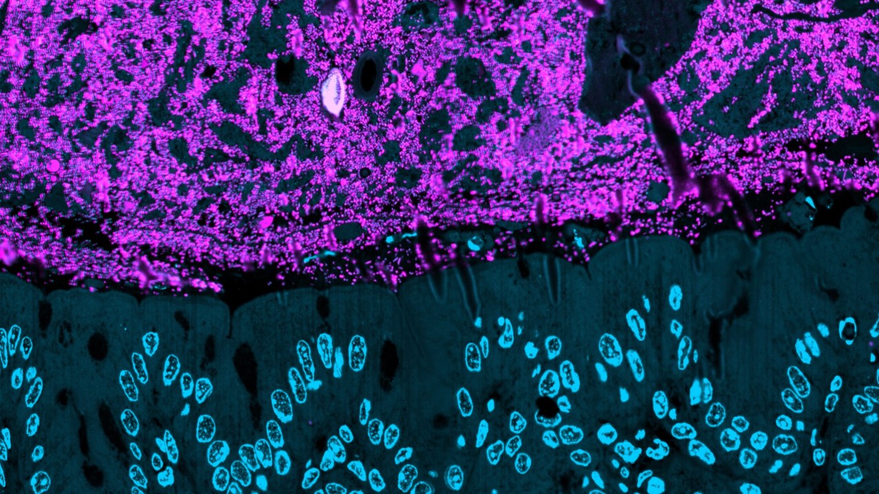 BACTÉRIAS INTESTINAIS: Células do intestino aparecem em azul e a diversidade de bactérias em magenta