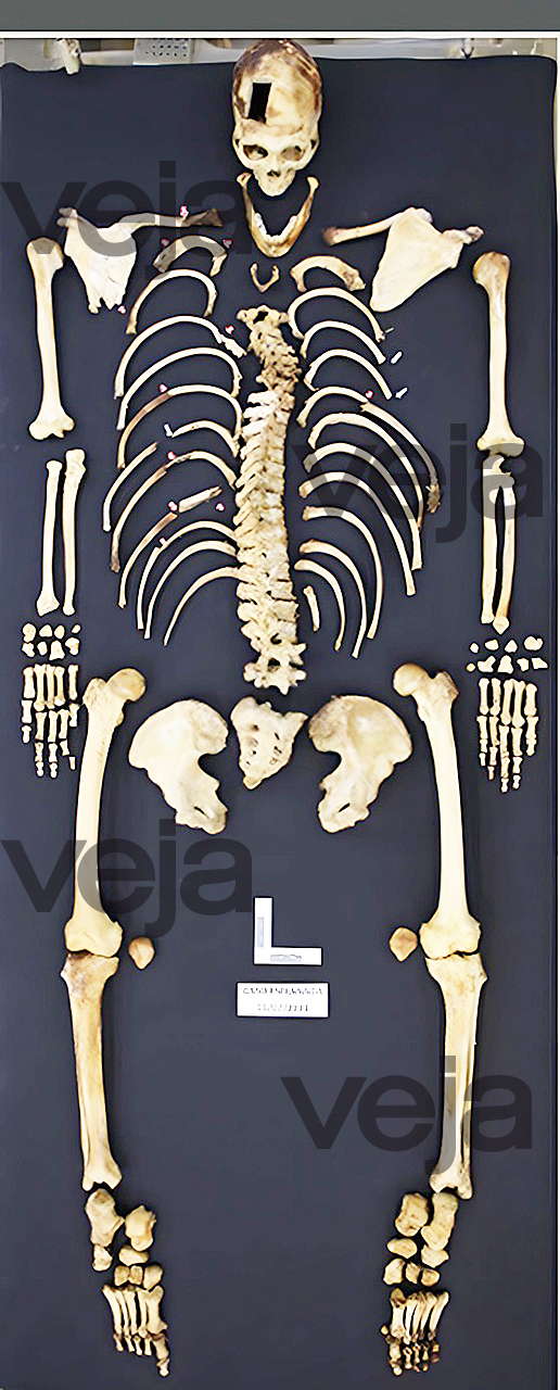 O CORPO FALA - O esqueleto do ex-policial: reconstrução para ajudar no caso