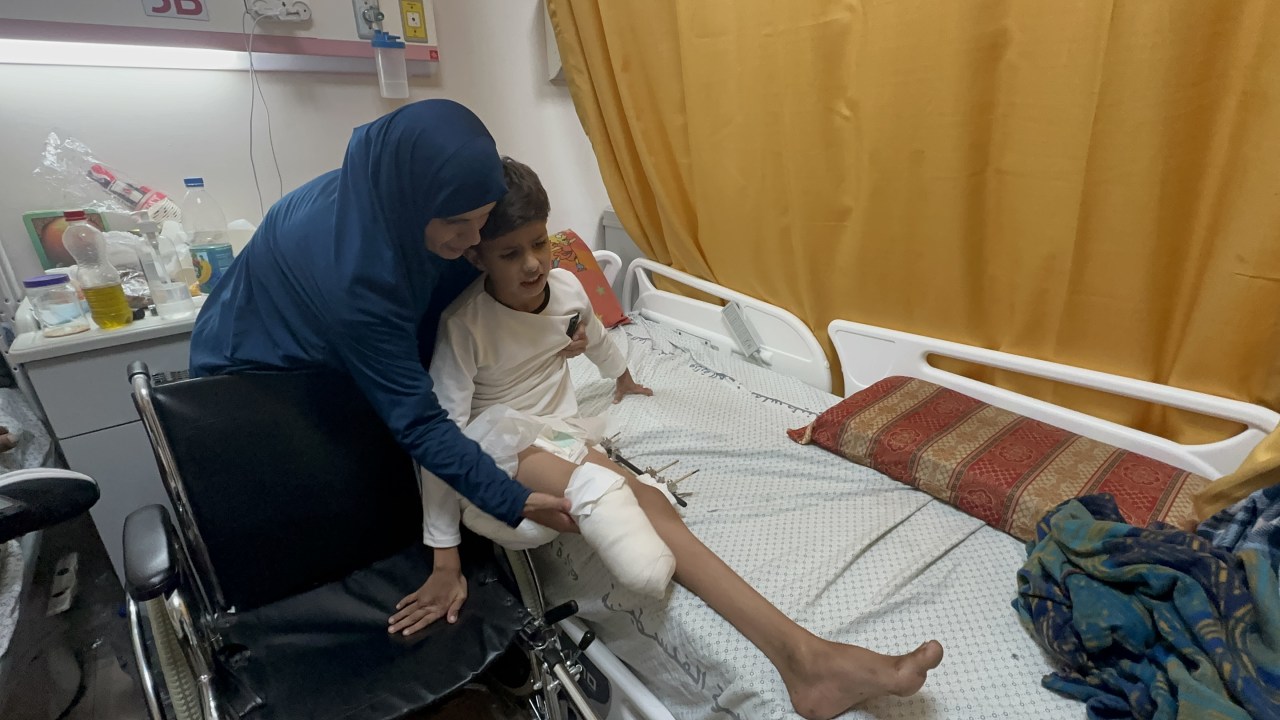 Saib Abu Muhadi, de 11 anos, teve a perna amputada após ataques israelenses ao campo de refugiados de Nasirat, em Gaza. 13/11/2023