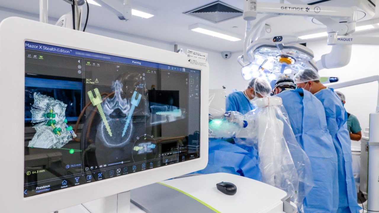 Robô Mazor em ação durante sua primeira participação em cirurgia de coluna no Brasil