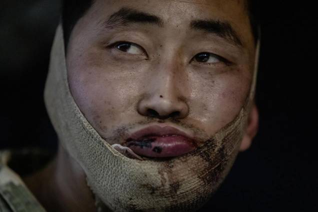 FERIDO NA MANDÍBULA - Soldado Norte-Coreano: capturado na Rússia FERIDO NA MANDÍBULA - Soldado Norte-Coreano: capturado na Rússia
