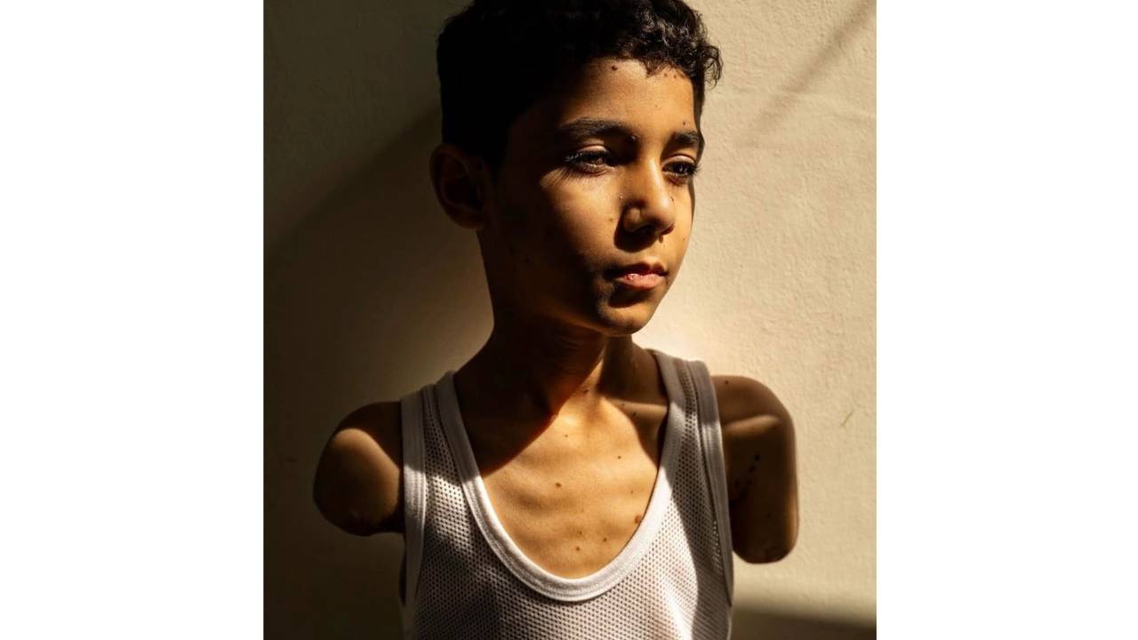 Retrato de Mahmoud Ajjour, de nove anos, que foi ferido durante um ataque israelense à Faixa de Gaza em março de 2024.