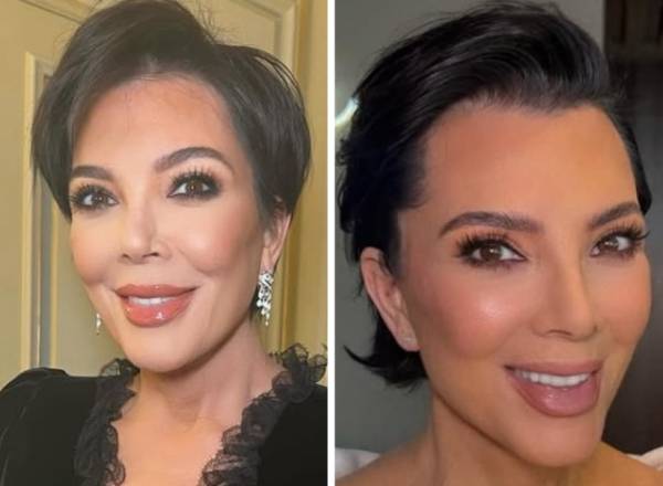 Antes e depois de Kris Jenner