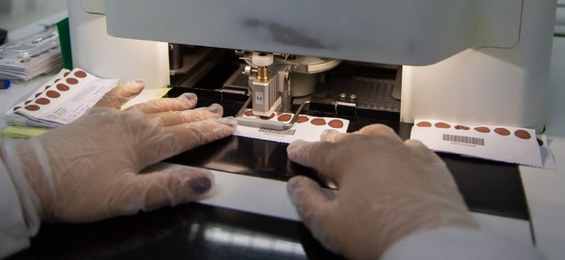 TESTE EM BEBÊS - Diagnóstico precoce: por meio de sangue do calcanhar, é possível detectar doenças genéticas, metabólicas e condições raras