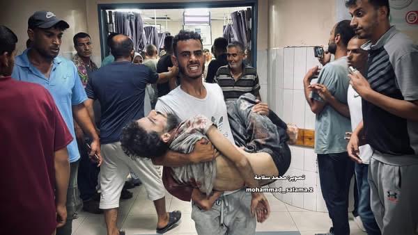 Abdullah Hammad, do Médicos Sem Fronteiras (MSF), é carregado para o hospital Nasser após um ataque direcionado das forças israelenses contra pessoas que tentavam coletar alimentos de caminhões de distribuição em 3 de julho