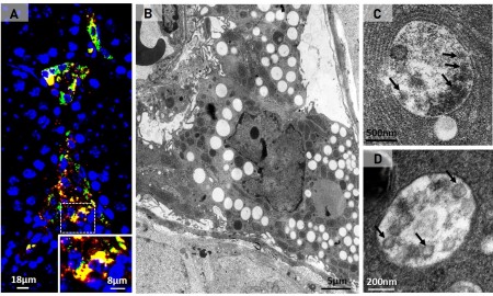 Covid: vírus usa células dos testículos para se multiplicar; entenda