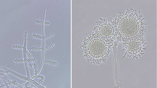Fotos de microscopia, com aumento de 40 vezes, mostram conidióforo com as vesículas cilíndricas da espécie Escovopsis weberi, mais eficientes na reprodução assexuada (à esq.) e vesículas globosas de Escovopsis papillata (dir.), espécie mais próxima do ancestral comum do gênero e menos eficiente nesse tipo de reprodução