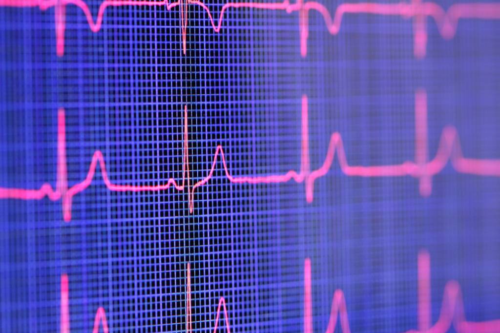 O pulso ainda pulsa… para alguns, infelizmente, não mais