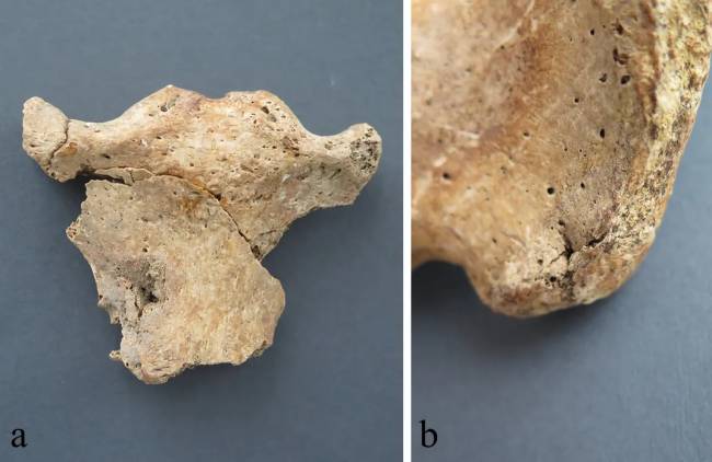 ferimentos ossos soldados romanos ferimentos ossos soldados romanos