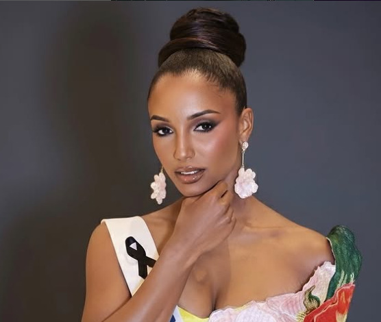 O estado de saúde da miss Jamaica após queda em concurso