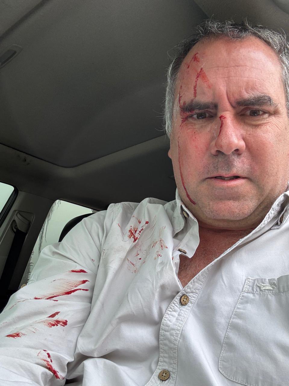 Pré-candidato à Presidência do Peru é alvo de ataque a tiros