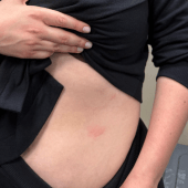 Laudo confirma lesões superficiais em Glauber e Sâmia