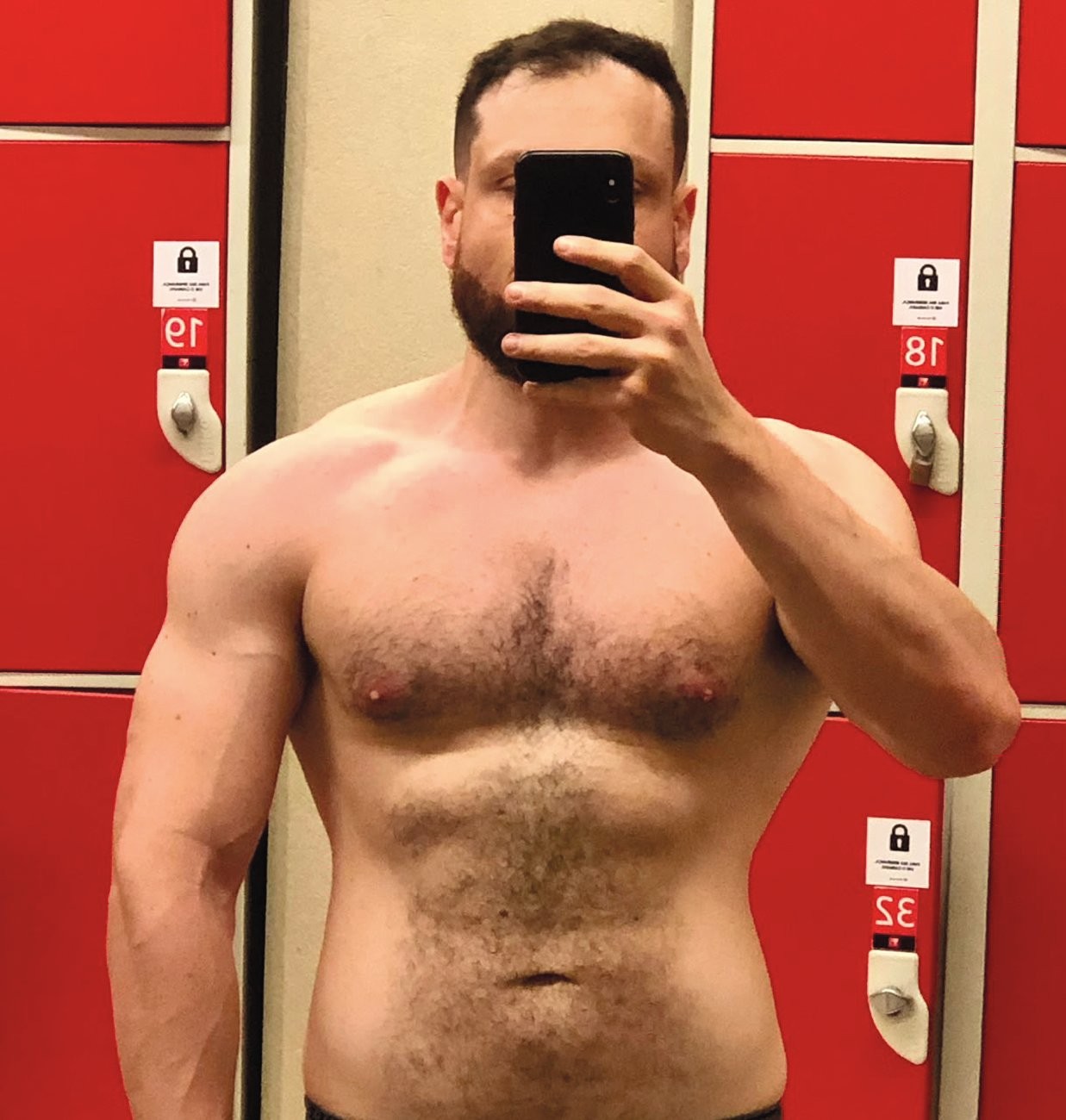 &ldquo;NINGU&Eacute;M SABE O RISCO&rdquo; - O m&eacute;dico Adriano Vendimiatti Cardoso, 47, conhecido nas redes sociais como Dr. Derrame, tornou-se hipertenso ap&oacute;s os esteroides. &ldquo;Ganhei um rem&eacute;dio de press&atilde;o para o resto da vida.&rdquo;