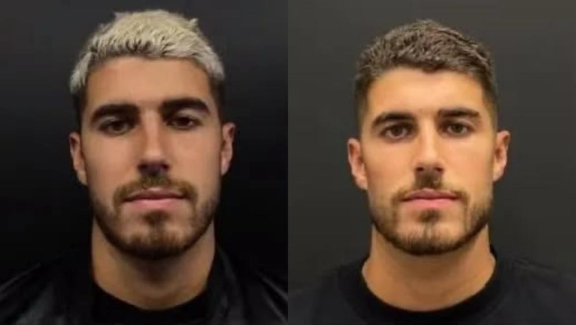 Comparativo de um homem jovem com barba e cabelo curto, loiro na imagem da esquerda e castanho na imagem da direita, ambos em fundo escuro