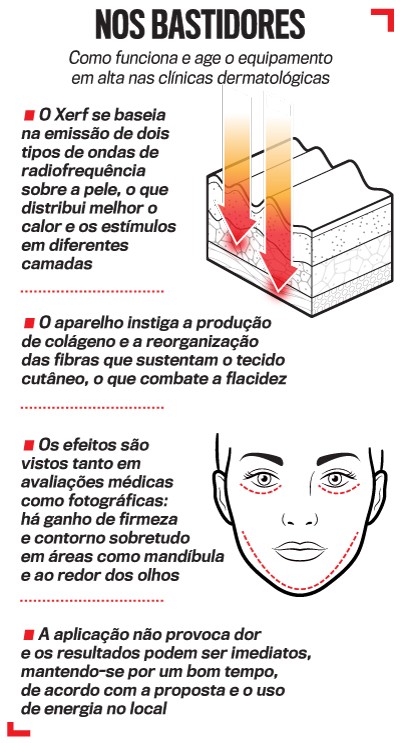 Infogr&aacute;fico sobre o funcionamento do equipamento XERF em cl&iacute;nicas dermatol&oacute;gicas. Ilustra a pele em camadas recebendo ondas de radiofrequ&ecirc;ncia, indicadas por setas vermelhas e laranjas, e um rosto com linhas pontilhadas vermelhas destacando &aacute;reas de tratamento na mand&iacute;bula e ao redor dos olhos. O texto descreve como o aparelho distribui calor, estimula col&aacute;geno e combate a flacidez, resultando em firmeza sem dor