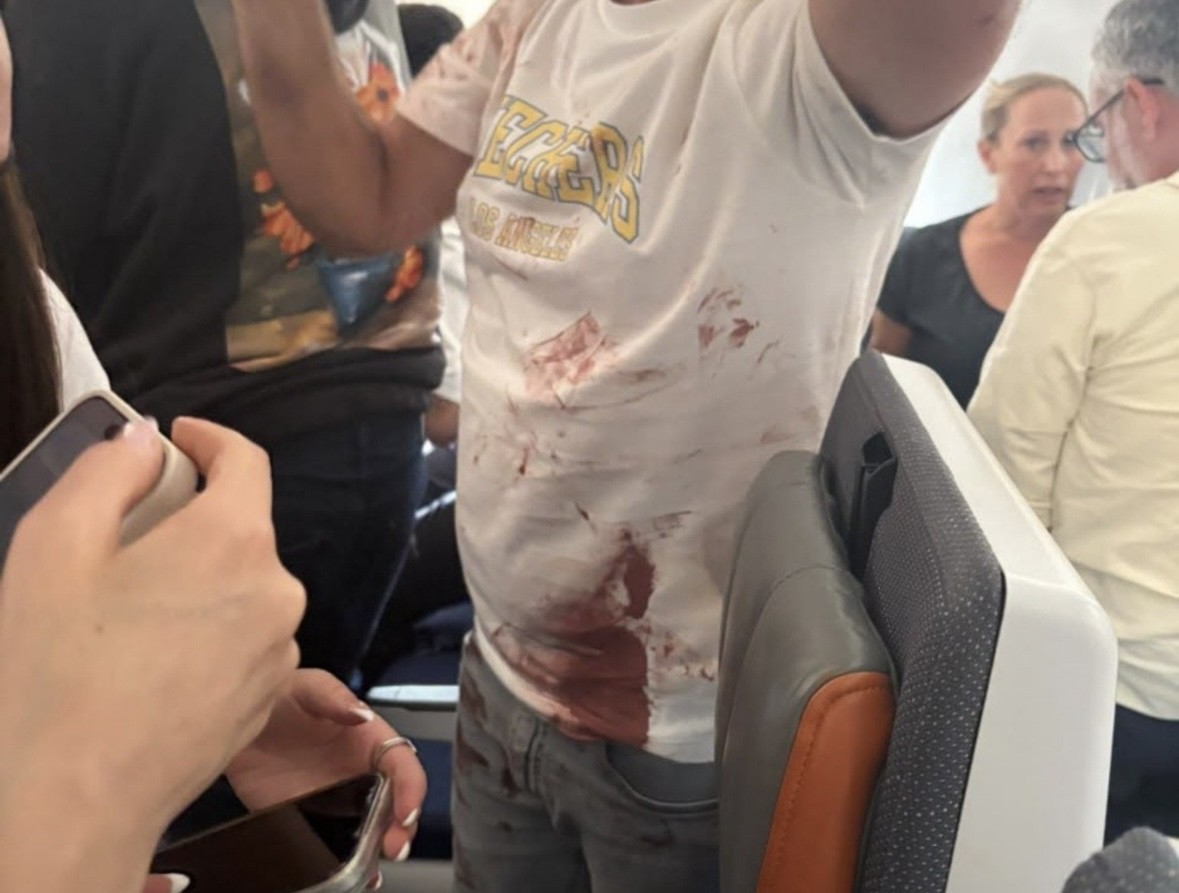 Vídeo mostra piloto e passageiros ensanguentados após briga em voo da Flydubai com destino a Israel