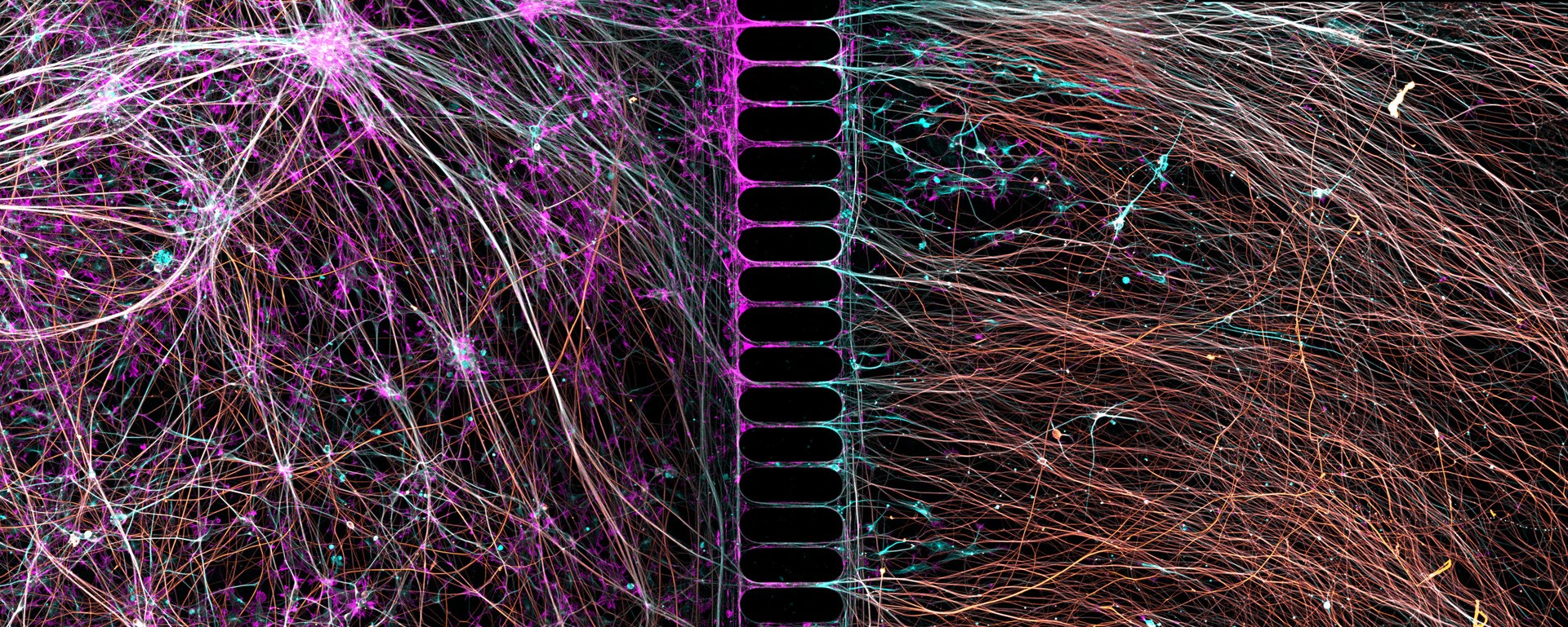 Representação abstrata de neurônios e sinapses. À esquerda, uma densa rede de filamentos finos em tons de roxo, rosa e branco, com pontos brilhantes azuis e brancos. Ao centro, uma coluna vertical preta com segmentos ovais. À direita, filamentos mais espaçados em tons de marrom, laranja e branco, com pontos azuis e brancos, tudo sobre fundo escuro