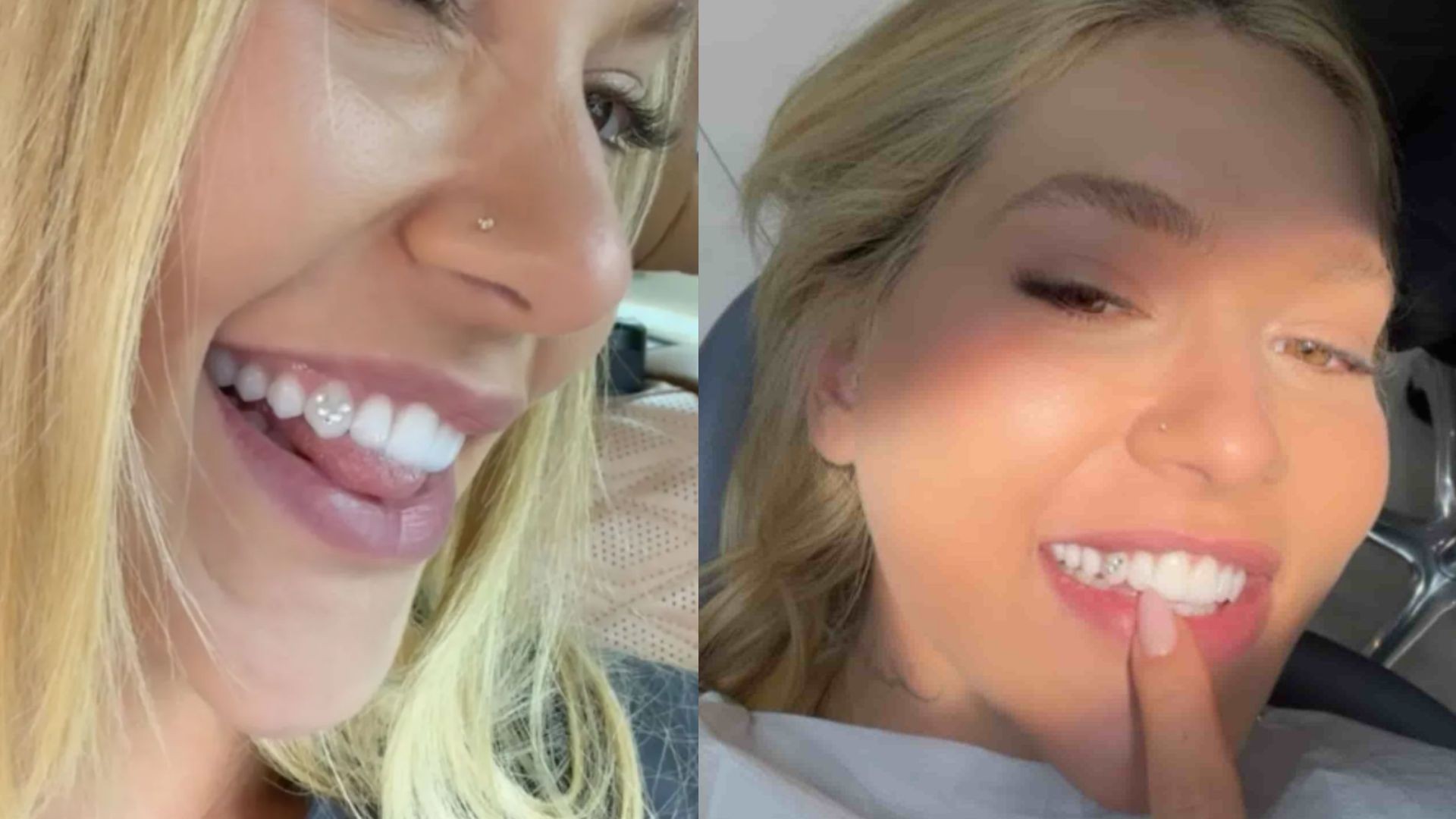 Duas fotos de uma mulher loira sorrindo, mostrando dentes brancos com joias. Na esquerda, ela sorri de perfil, exibindo um piercing no nariz e um dente com pérolas. Na direita, ela sorri de frente, apontando para o dente com joias, com um dedo na boca